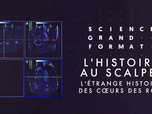 Science grand format - L'histoire au scalpel - L'étrange histoire des cœurs des rois